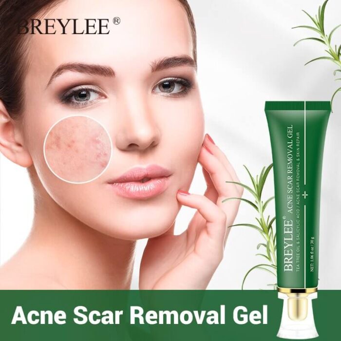 Breylee Acne Scar Removal Gel-2 Breylee Acne Scar Removal Gel-2