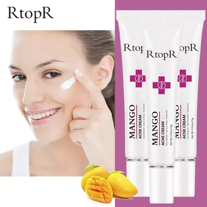 RTOPR Mango Repair Acne Cream-3 RTOPR Mango Repair Acne Cream-3