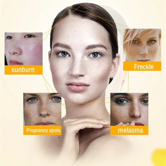 Dimore Dimollaure Herbal Whitening Freckle Cream-5 Dimore Dimollaure Herbal Whitening Freckle Cream-5