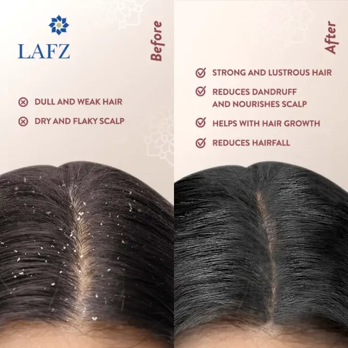 Lafz Onion Seed Essential Oil For Hair-6 Lafz Onion Seed Essential Oil For Hair-6