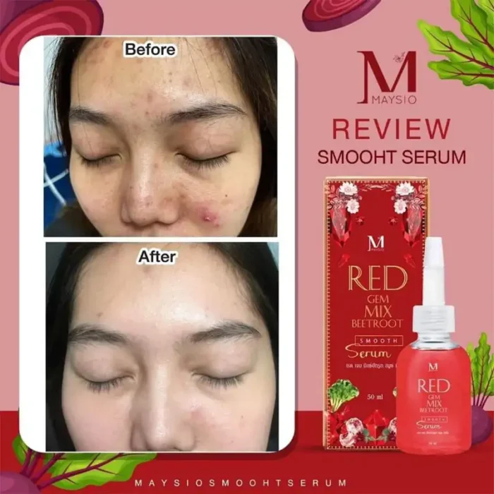 Maysio Red GEM Mix Beetroot Smooth Serum Maysio Red GEM Mix Beetroot Smooth Serum
